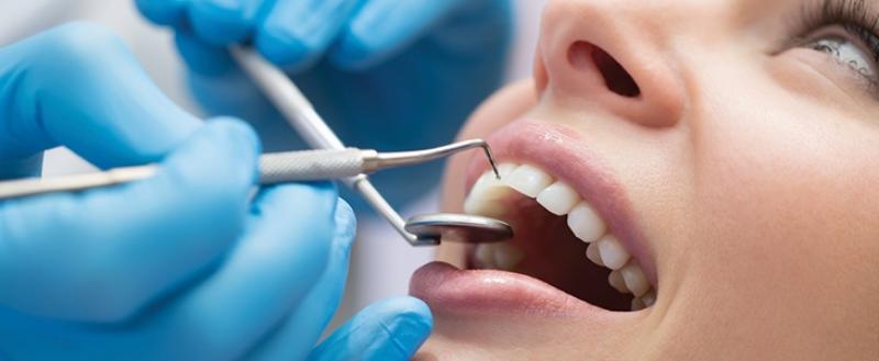 66% popust na ultrazvočno čiščenje zobnega